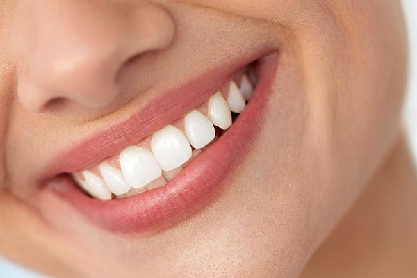 The image shows a close-up of a smiling person with straight white teeth, displaying a wide smile with their mouth open, against a plain background.